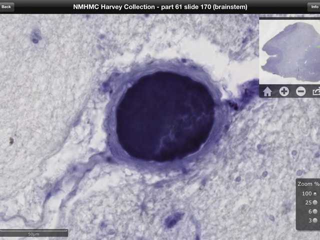 Einstein's brain is now interactive iPad app 
